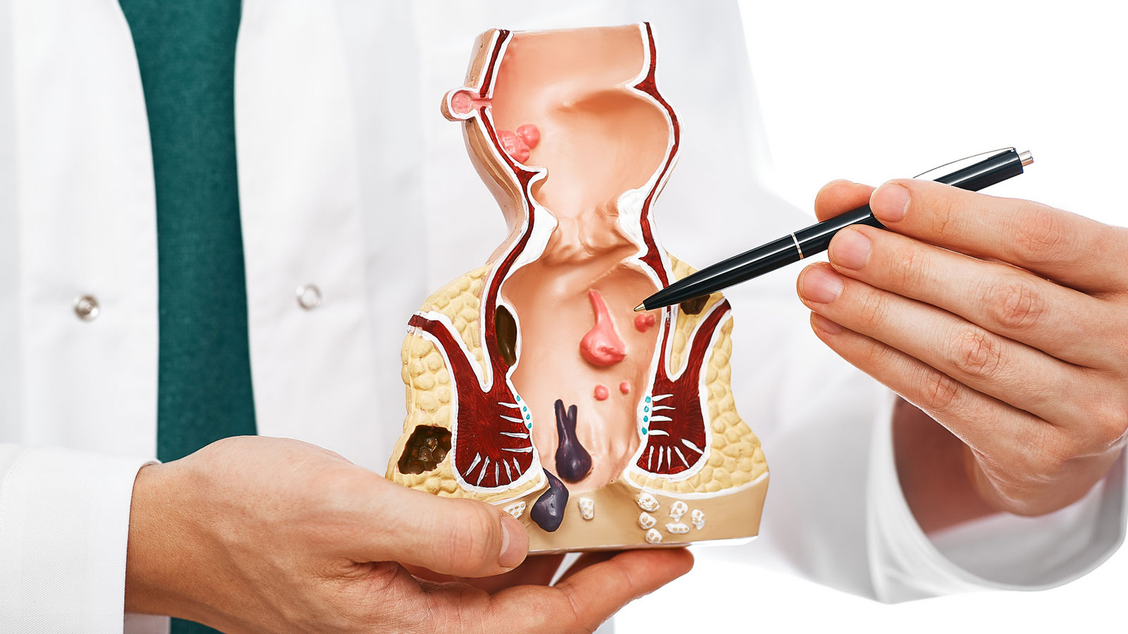 Hemorrhoid Clinic Near Me: Expert Care for Fast Relief